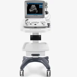 Échographe portable à ultrasons Edan DUS60, appareil compact et puissant pour diagnostics médicaux avec technologie Doppler et THI.