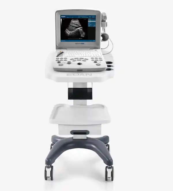 Échographe portable à ultrasons Edan DUS60, appareil compact et puissant pour diagnostics médicaux avec technologie Doppler et THI.